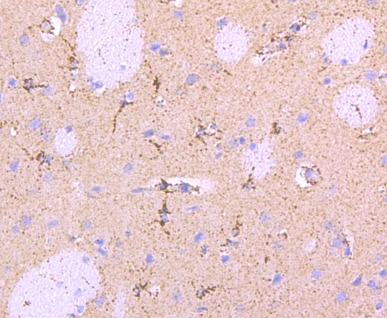 Anti-PRKN Antibody (1X34)