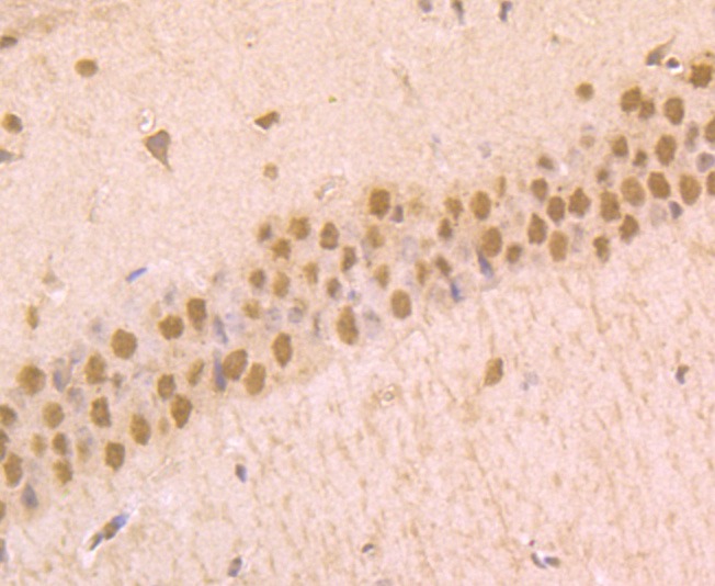 Anti-Phospho-Alpha-Synuclein (Ser129) Antibody (7E158)