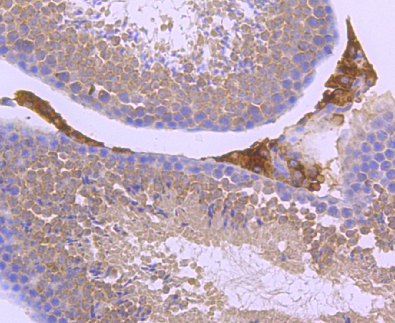 Anti-PRKN Antibody (1X34)