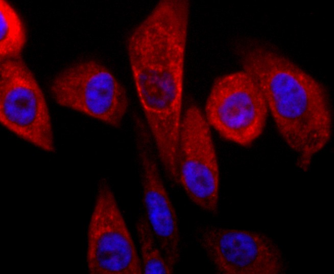 Anti-PRKN Antibody (1X34)
