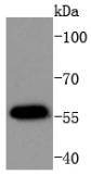 Anti-Phospho-AKT1 (Thr450) Antibody (2R55)