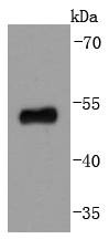 Anti-p53 Antibody (4S402)