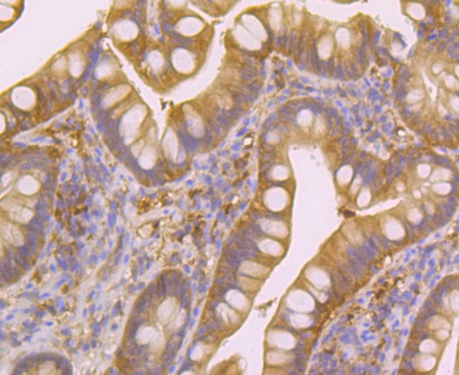 Anti-Nudel Antibody (5F982)