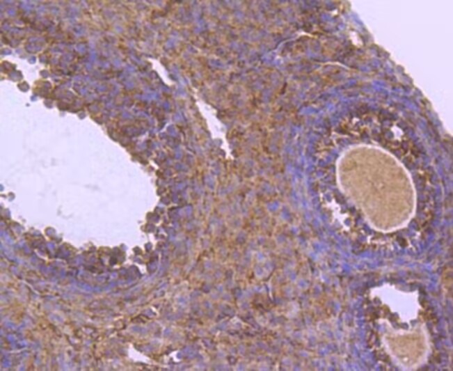 Anti-NR4A1 Antibody (7O127)