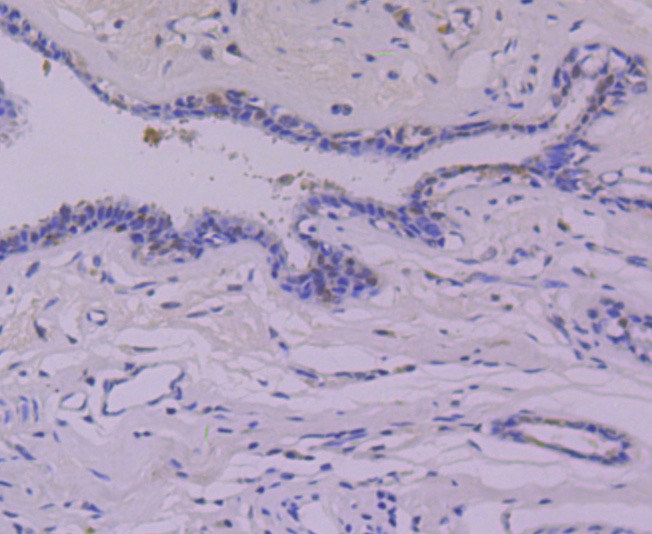 Anti-p53 Antibody (5M213)
