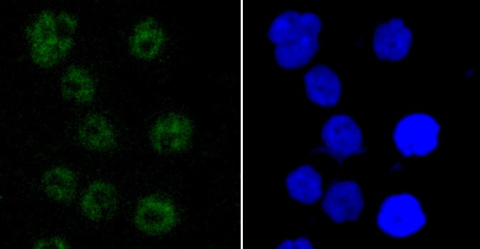 Anti-PABPN1 Antibody (3P321)