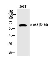 Anti-Phospho-p63 (Ser455) Polyclonal Antibody