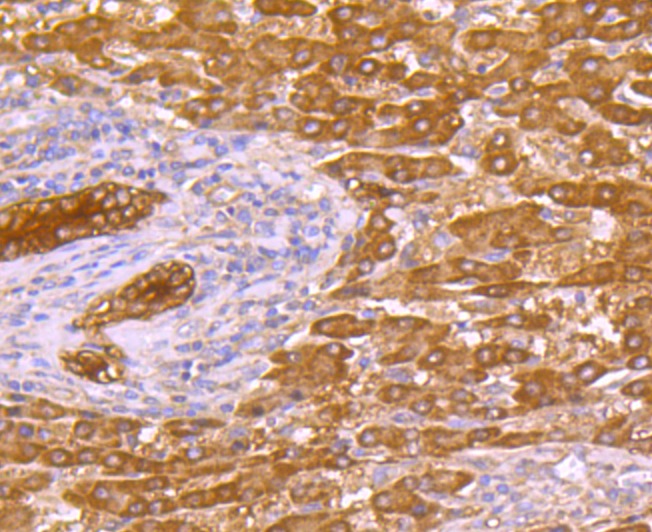 Anti-p53 DINP1 Antibody (7A906)