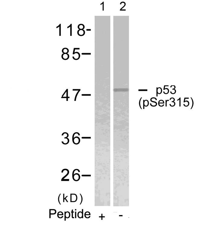 Anti-Phospho-p53 (Ser315) Polyclonal Antibody