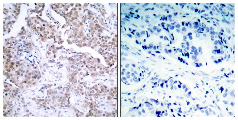 Anti-Phospho-p53 (Ser15) Polyclonal Antibody 2