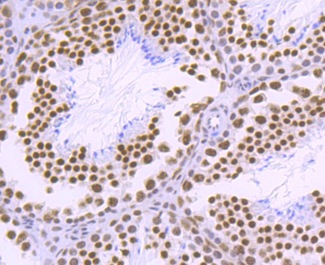 Anti-PABPN1 Antibody (3P321)