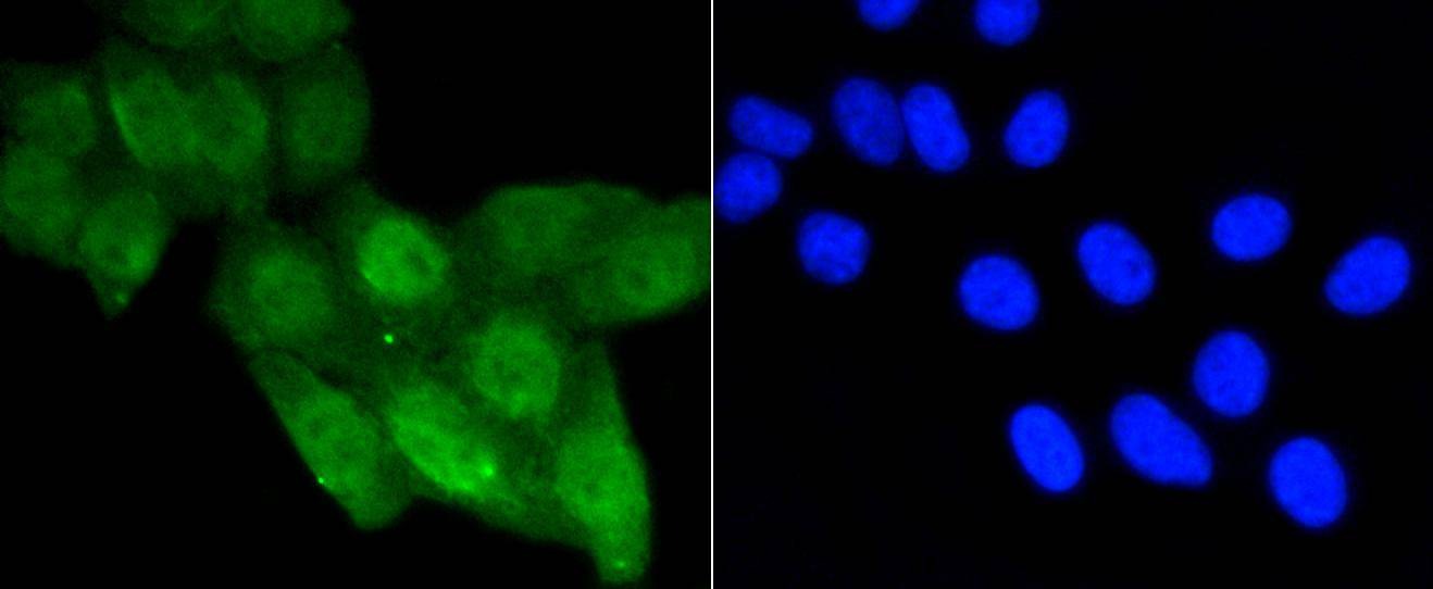 Anti-Acetyl-p53 (Lys370) Antibody (8D75)