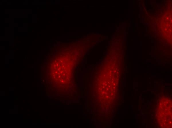 Anti-Phospho-p90RSK (Thr348) Polyclonal Antibody