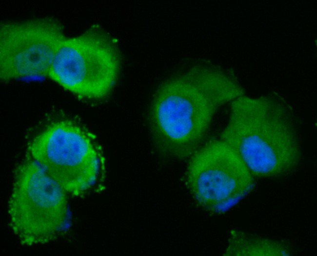 Anti-p53 DINP1 Antibody (7A906)
