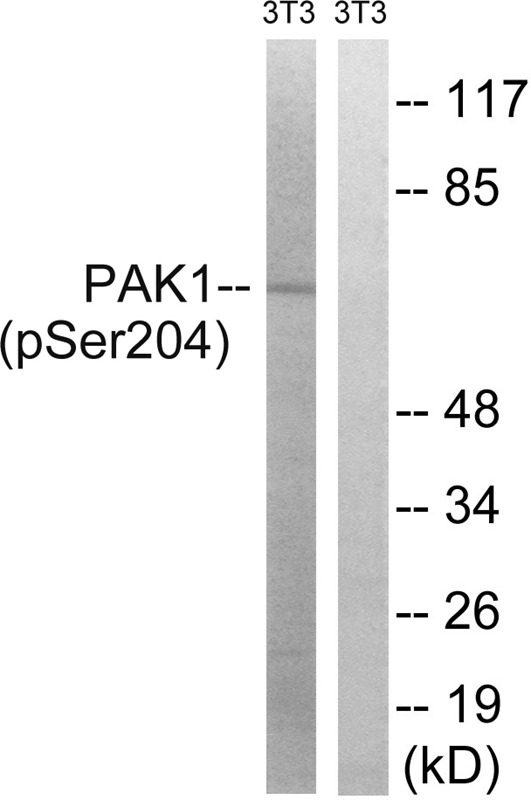 Anti-Phospho-PAK1 (Ser204) Polyclonal Antibody