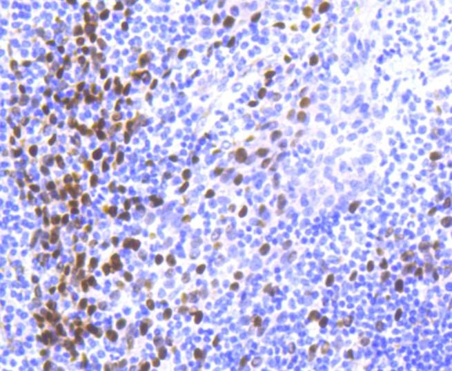 Anti-p63 Antibody (4X27)