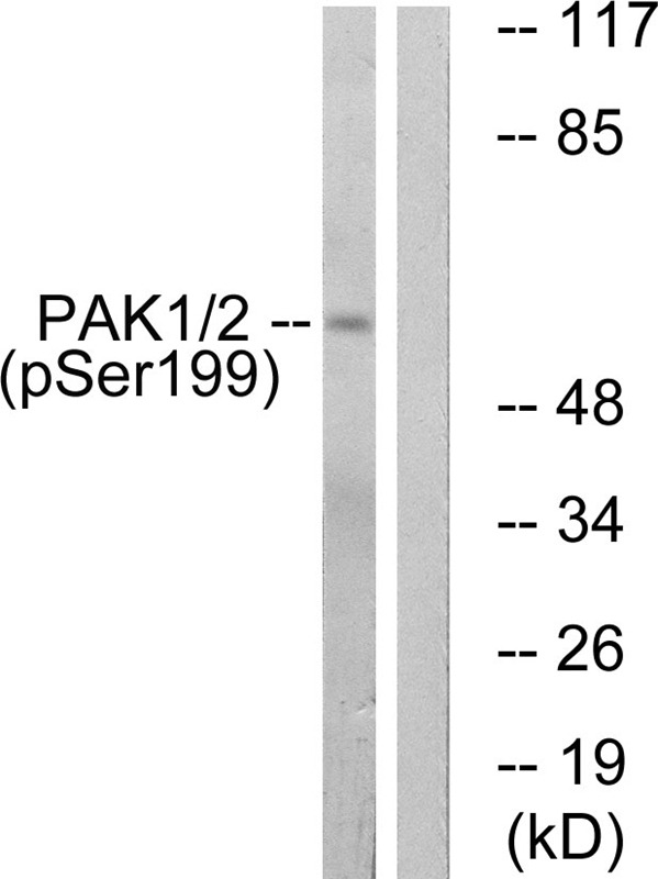 Anti-Phospho-PAK1 (Ser199) Polyclonal Antibody