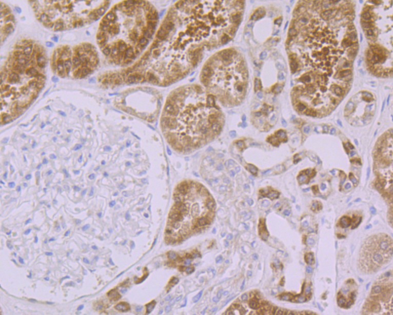 Anti-p53 DINP1 Antibody (7A906)
