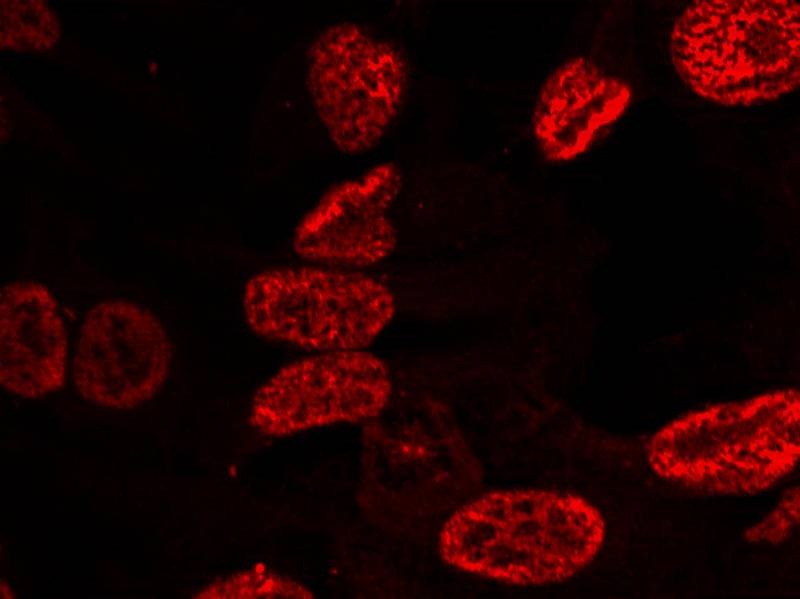 Anti-Phospho-p53 (Ser15) Polyclonal Antibody 2
