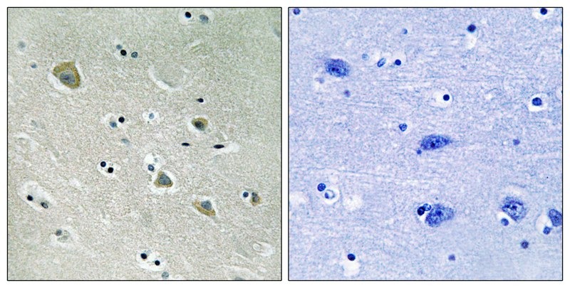 Anti-Phospho-PAK1 (Ser204) Polyclonal Antibody