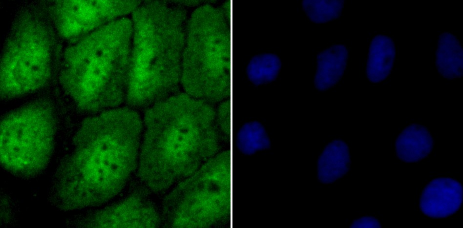 Anti-NUP153 Antibody (4X360)