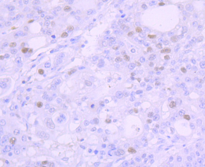 Anti-p53 Antibody (5M213)