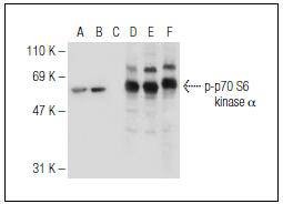 Anti-Phospho-p70 S6 Kinase (Ser 411) Antibody (7V681)