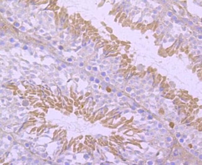 Anti-NR4A1 Antibody (7O127)