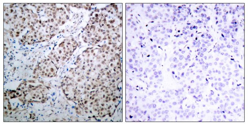 Anti-Phospho-p53 (Ser315) Polyclonal Antibody