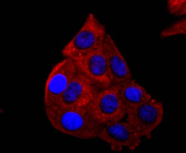 Anti-p53 Antibody (4S402)