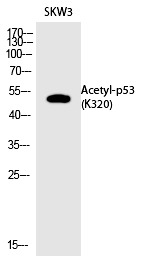 Anti-Acetyl-p53 (Lys320) Polyclonal Antibody