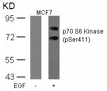 Anti-Phospho-S6K1/RPS6KB1 (Ser411) Polyclonal Antibody