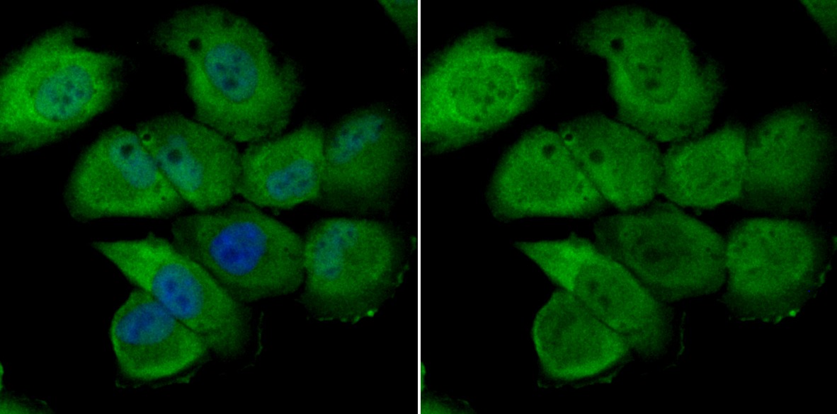 Anti-Nuclear Matrix Protein p84 Antibody (8Q603)