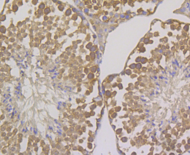 Anti-OS9 Antibody (8R432)
