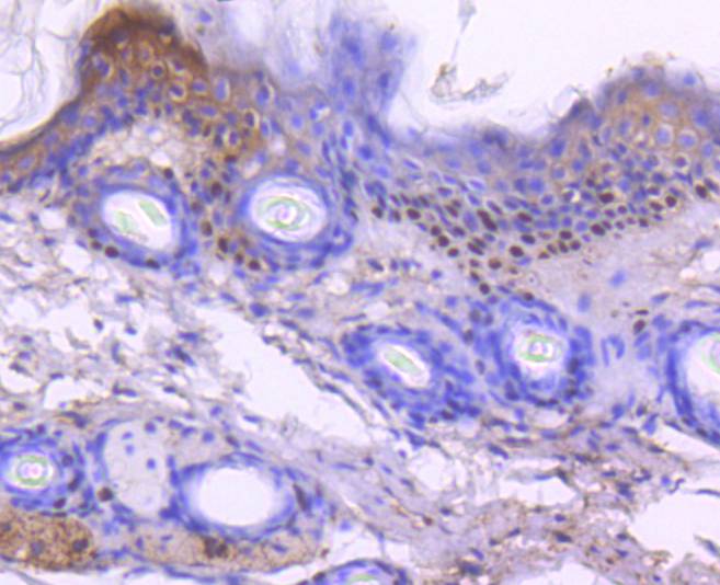 Anti-p73 Antibody (2O496)