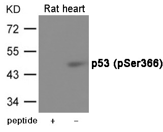 Anti-Phospho-p53 (Ser366) Polyclonal Antibody