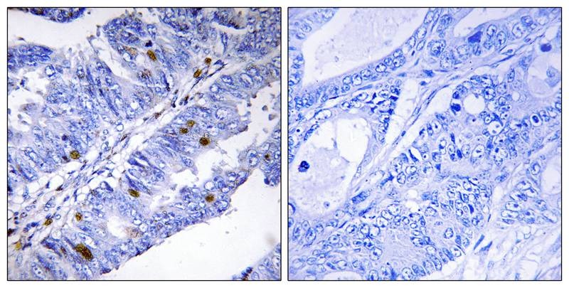 Anti-Phospho-NR4A1 (Ser351) Polyclonal Antibody 2