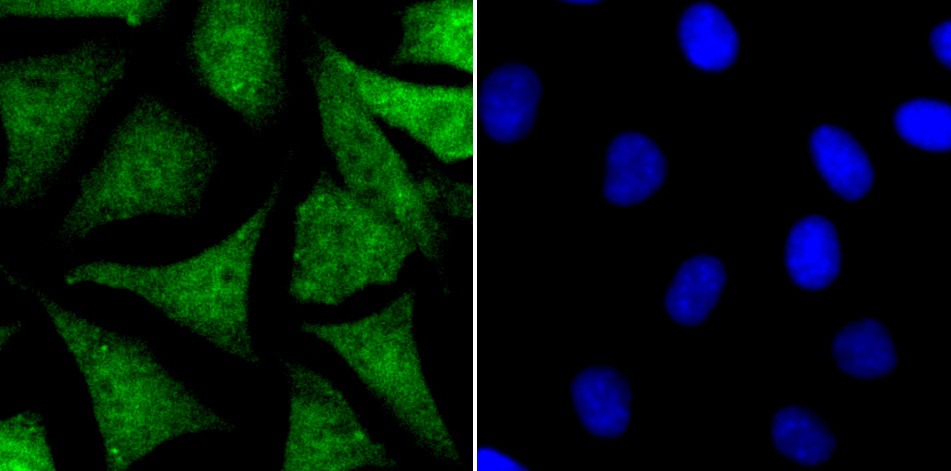 Anti-NR0B1 Antibody (2T380)