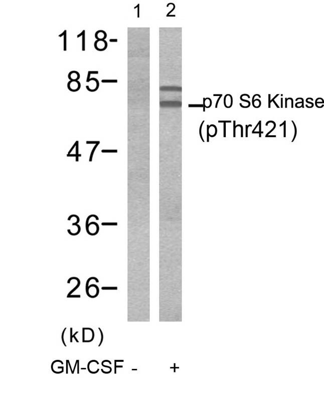 Anti-Phospho-S6K1/RPS6KB1 (Thr421) Polyclonal Antibody