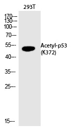 Anti-Acetyl-p53 (Lys372) Polyclonal Antibody