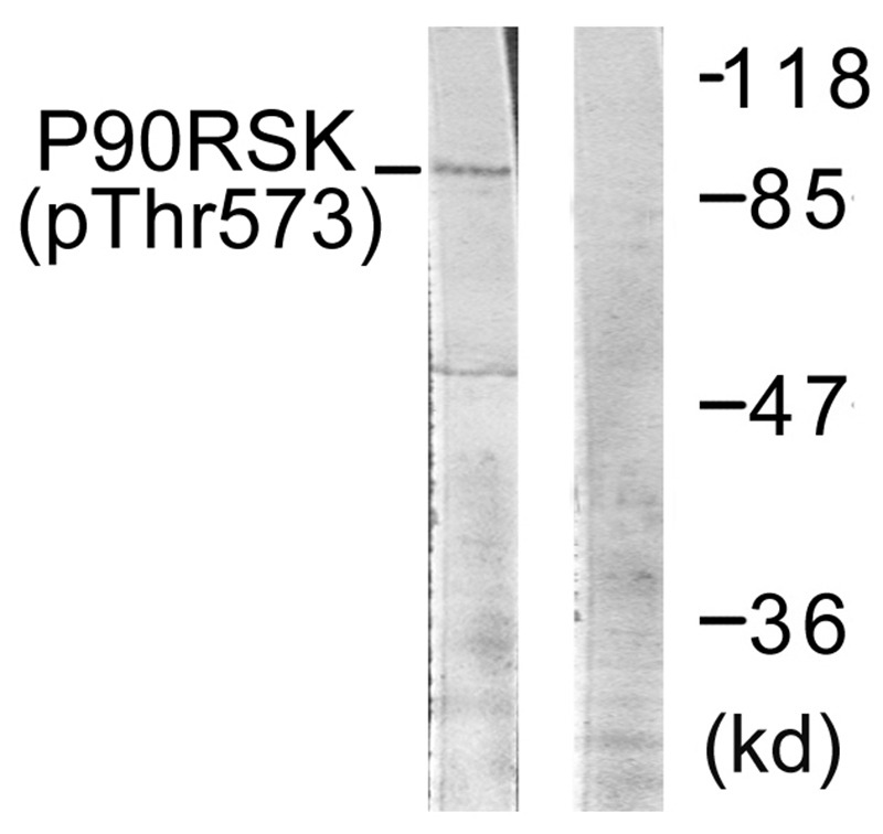 Anti-Phospho-RPS6KA1 (Thr573) Polyclonal Antibody 2