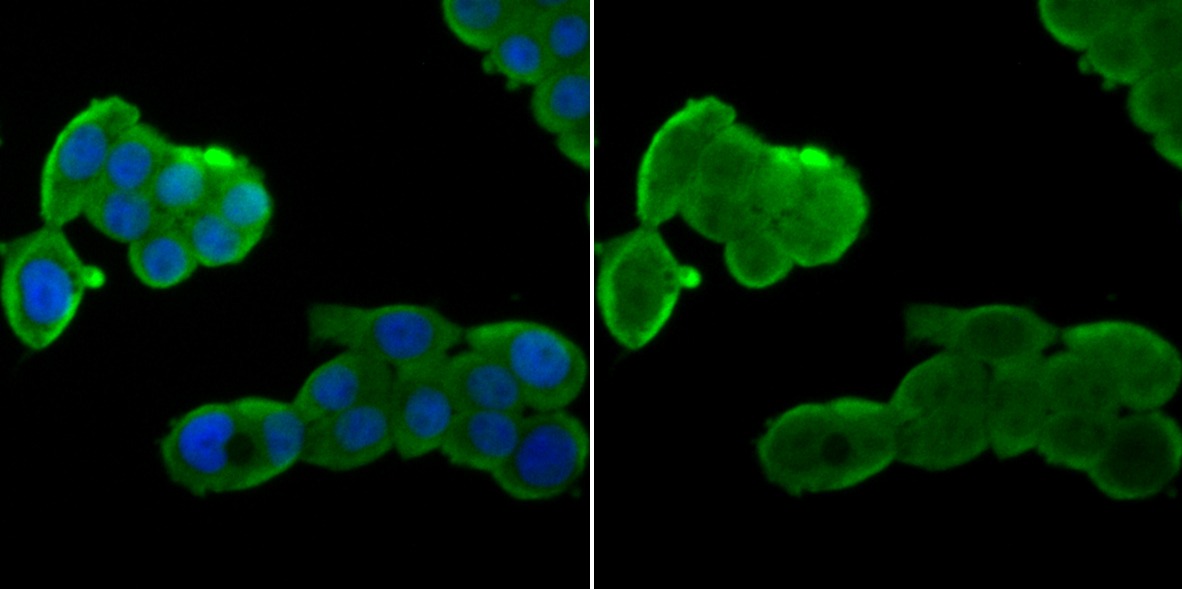 Anti-Nuclear Matrix Protein p84 Antibody (8Q603)