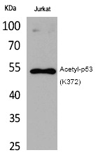 Anti-Acetyl-p53 (Lys372) Polyclonal Antibody