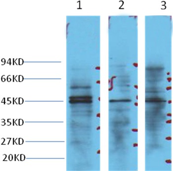 Anti-NSE/ENO2 Antibody (7Z725)