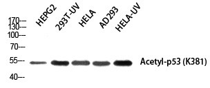 Anti-Acetyl-p53 (Lys381) Polyclonal Antibody