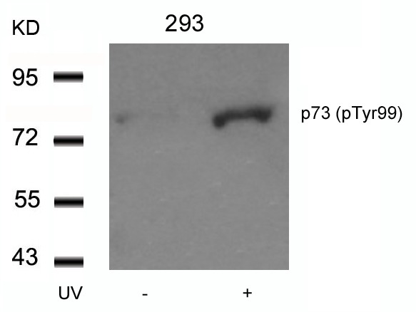 Anti-Phospho-p73 (Tyr99) Polyclonal Antibody