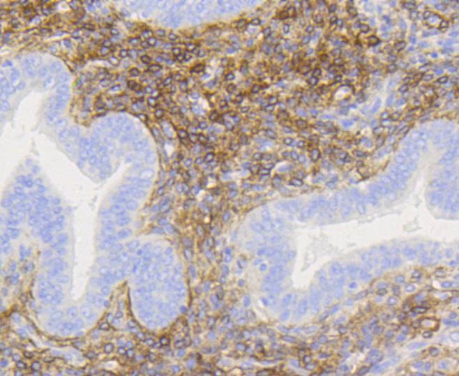 Anti-NGFR/p75NTR Antibody (2N149)