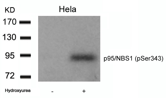 Anti-Phospho-NBN (Ser343) Polyclonal Antibody