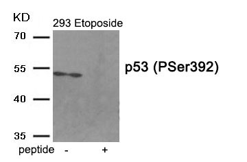 Anti-Phospho-p53 (Ser392) Polyclonal Antibody