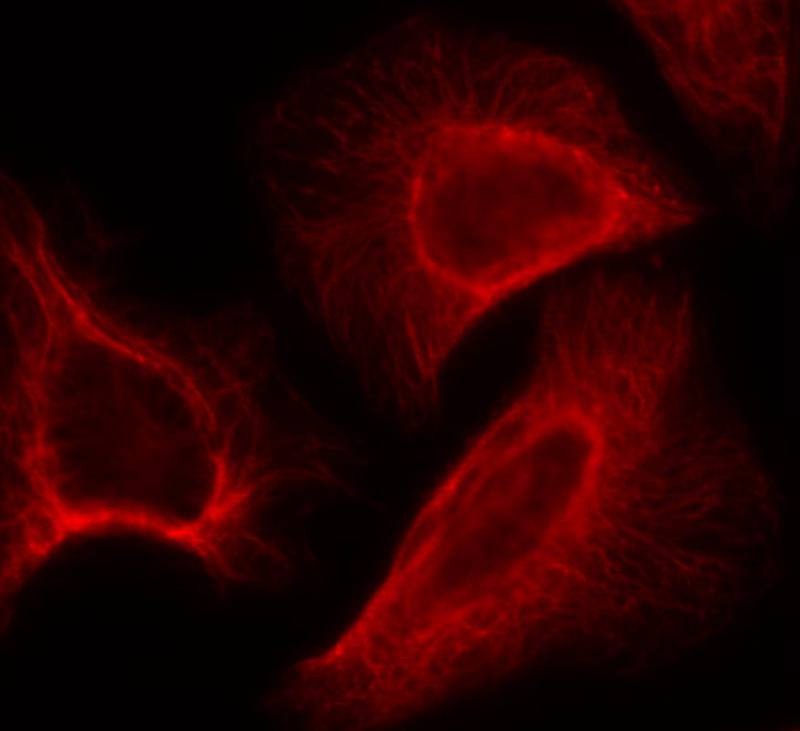 Anti-Phospho-S6K1/RPS6KB1 (Ser424) Polyclonal Antibody